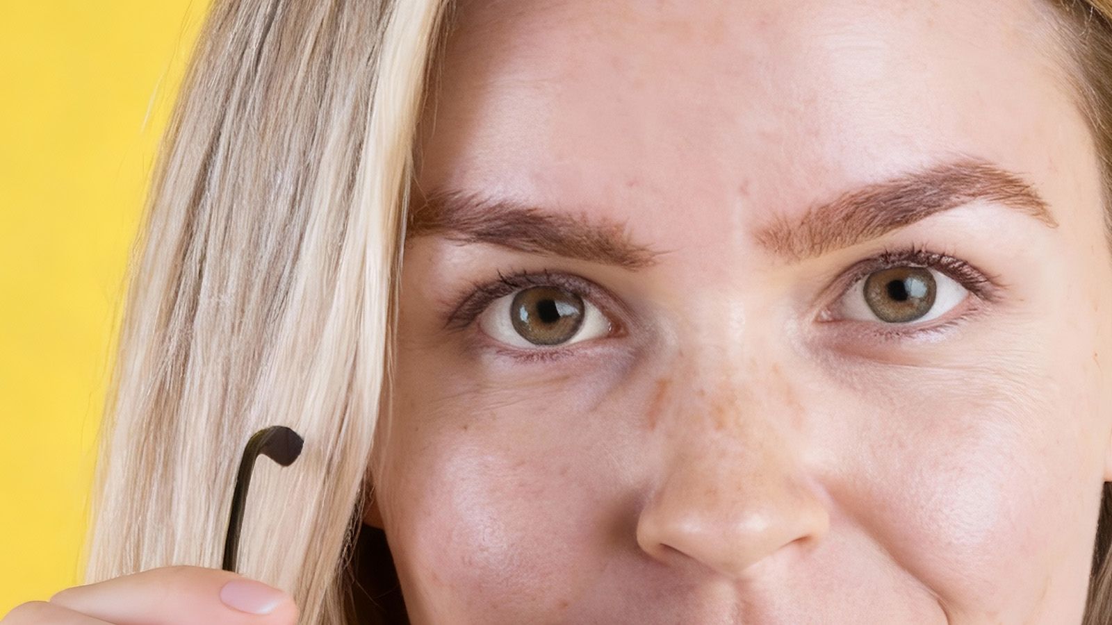 Close-up of red eyeglass marks and dents on nose from nose pads