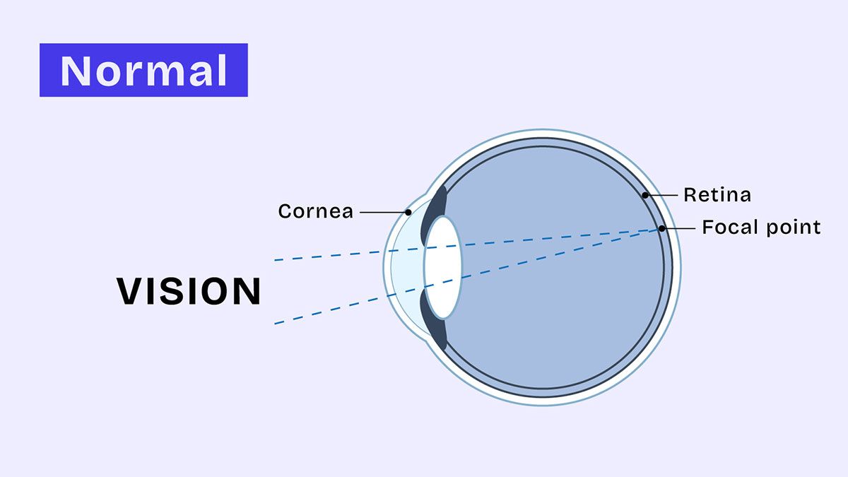 Regular Lenses