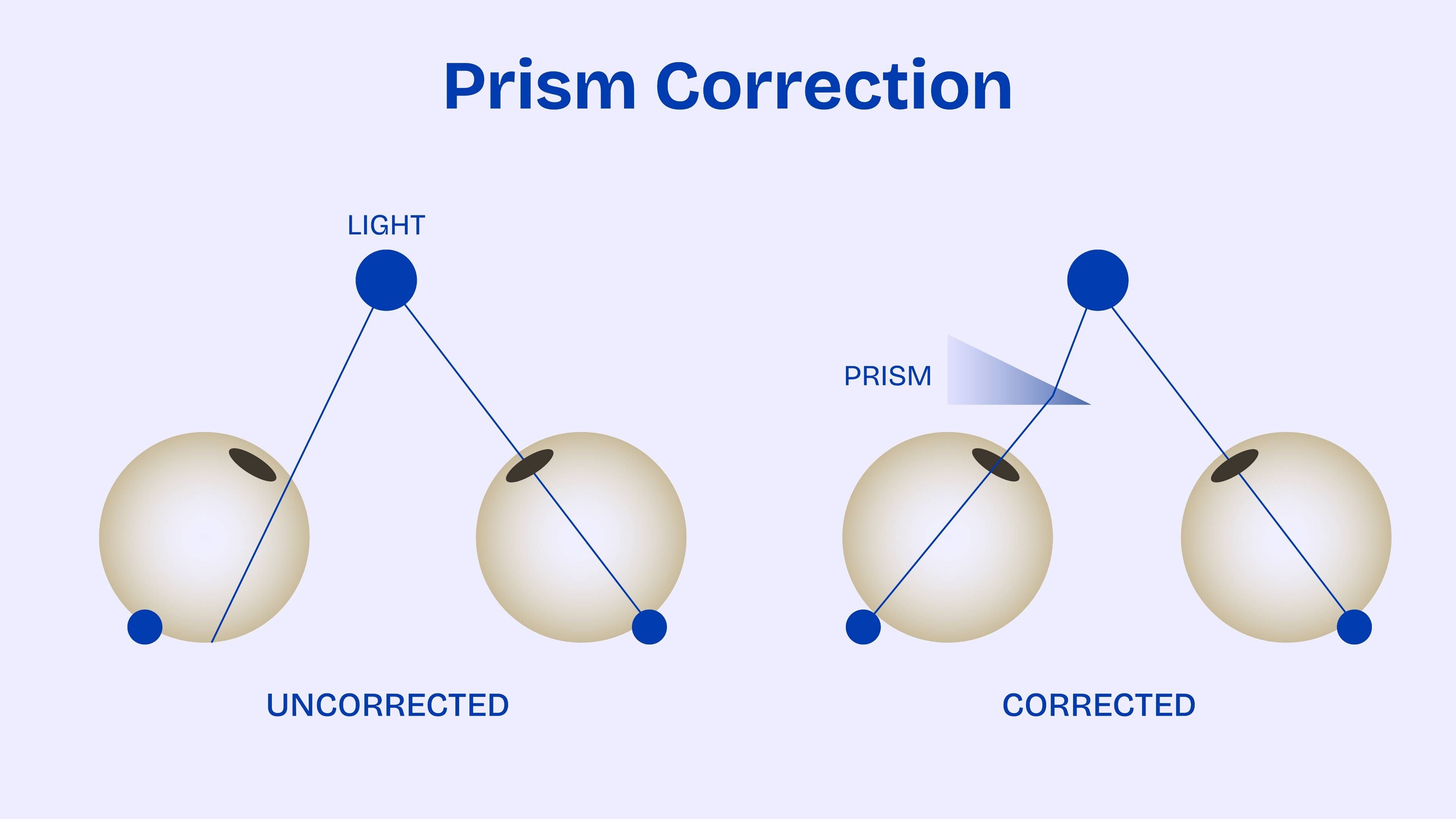 A diagram illustrating prism correction for vision.